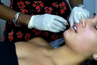 dr desmer destang dermal fillers st. lucia caribbean