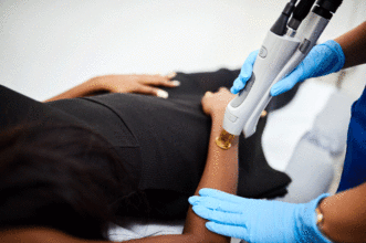 laser hair removal desmer destang